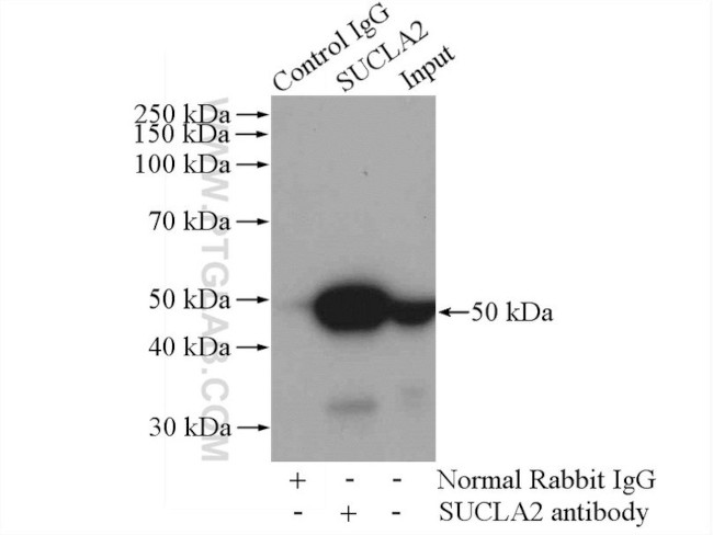 SUCLA2 Antibody in Immunoprecipitation (IP)