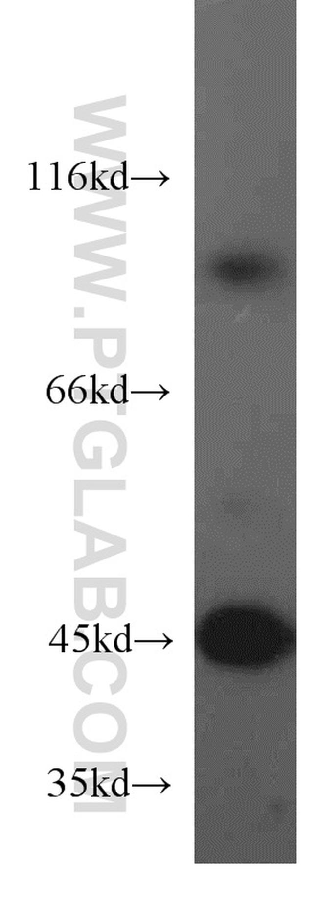 SUCLA2 Antibody in Western Blot (WB)