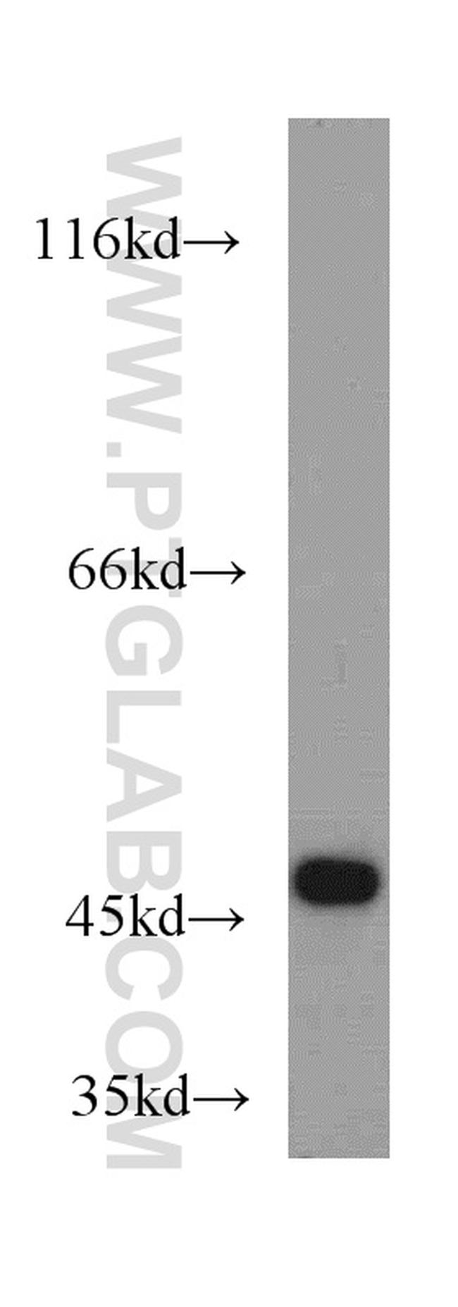 SUCLA2 Antibody in Western Blot (WB)