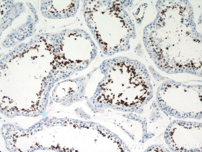 Calmegin Antibody in Immunohistochemistry (Paraffin) (IHC (P))