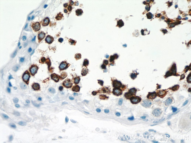 Calmegin Antibody in Immunohistochemistry (Paraffin) (IHC (P))