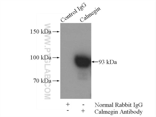 Calmegin Antibody in Immunoprecipitation (IP)