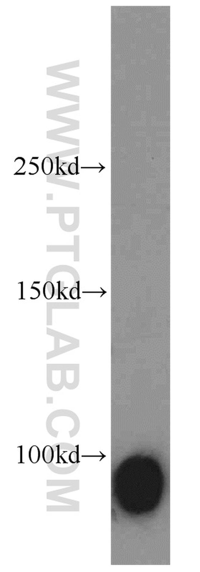 Calmegin Antibody in Western Blot (WB)