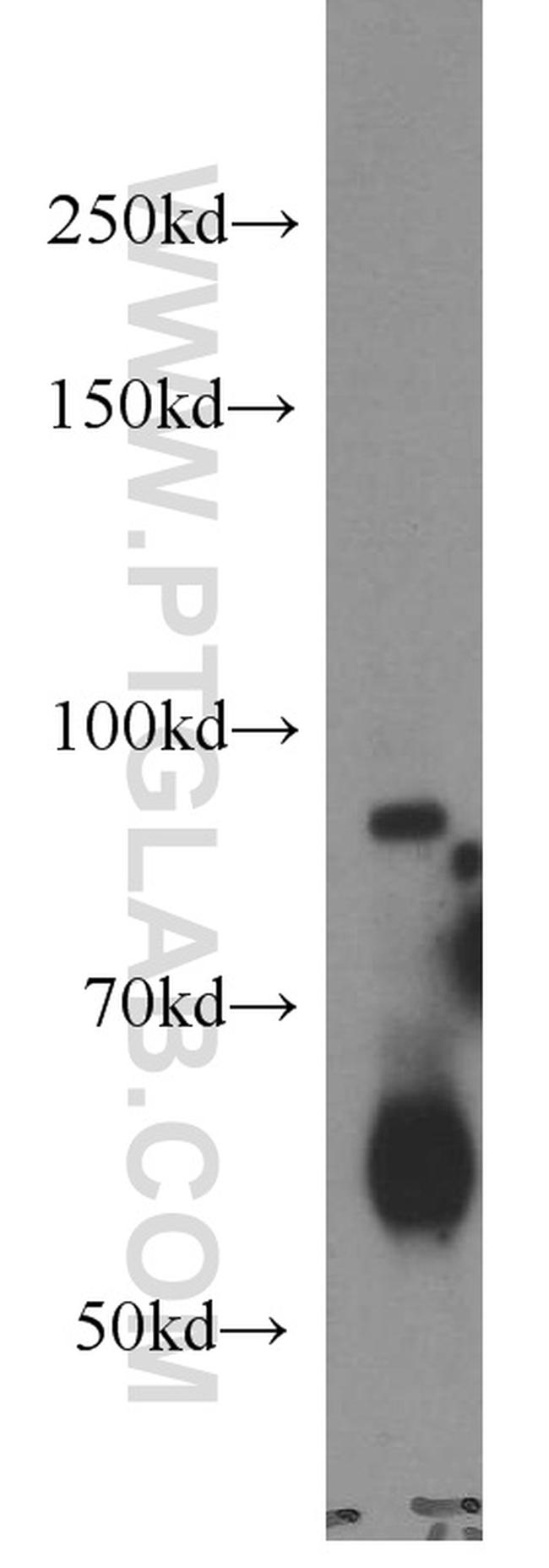 Calmegin Antibody in Western Blot (WB)