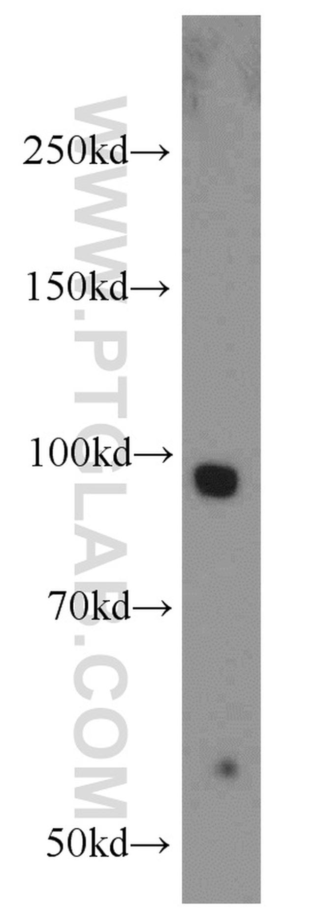 Calmegin Antibody in Western Blot (WB)