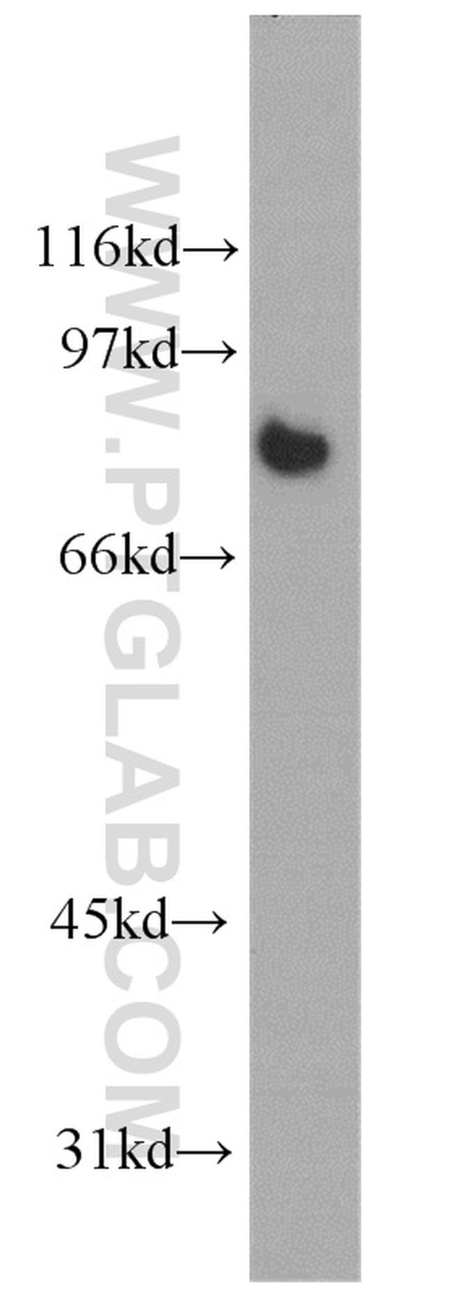 Calmegin Antibody in Western Blot (WB)