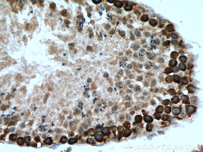 DAZL Antibody in Immunohistochemistry (Paraffin) (IHC (P))