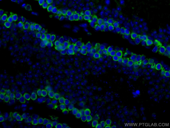 DAZL Antibody in Immunohistochemistry (PFA fixed) (IHC (PFA))