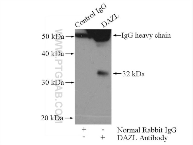 DAZL Antibody in Immunoprecipitation (IP)