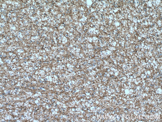 GNAO1 Antibody in Immunohistochemistry (Paraffin) (IHC (P))