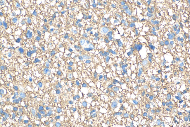 GNAO1 Antibody in Immunohistochemistry (Paraffin) (IHC (P))