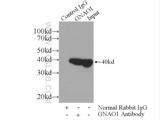 GNAO1 Antibody in Immunoprecipitation (IP)