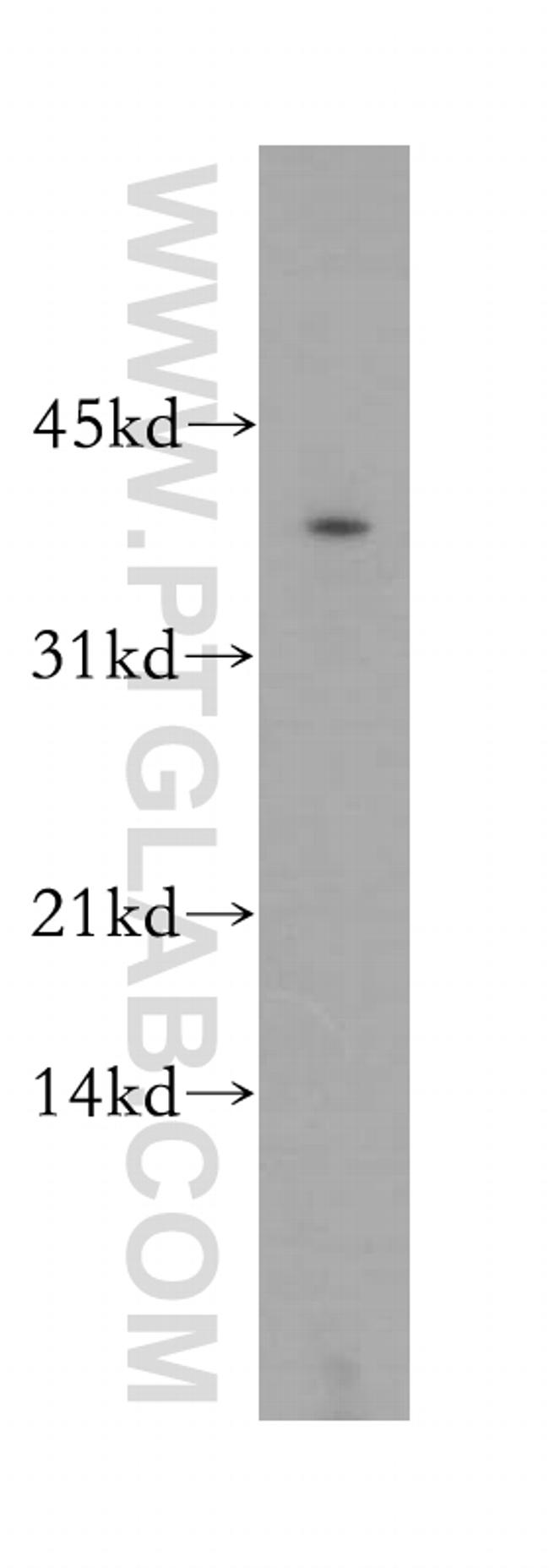 GNAO1 Antibody in Western Blot (WB)