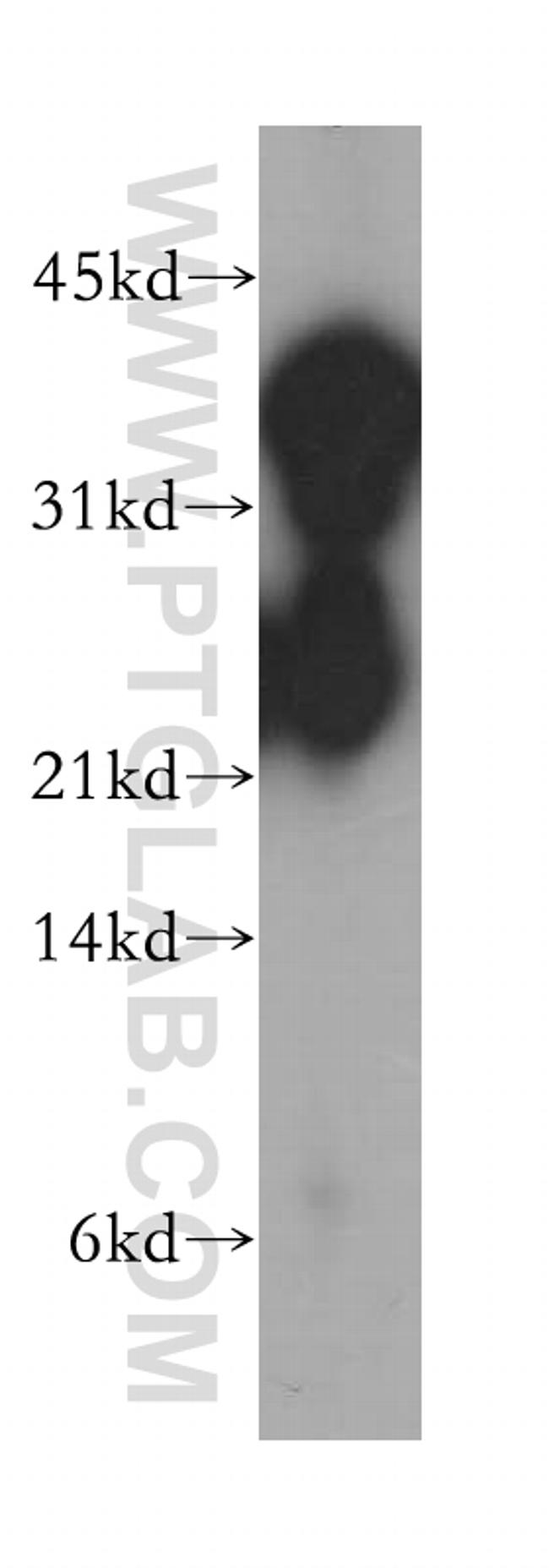 GNAO1 Antibody in Western Blot (WB)