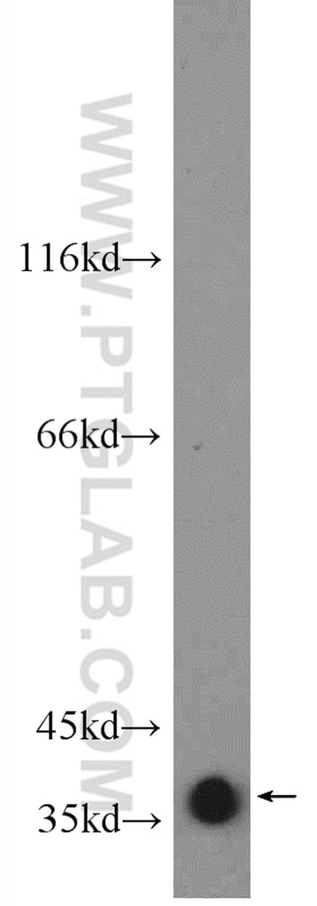 GNAO1 Antibody in Western Blot (WB)