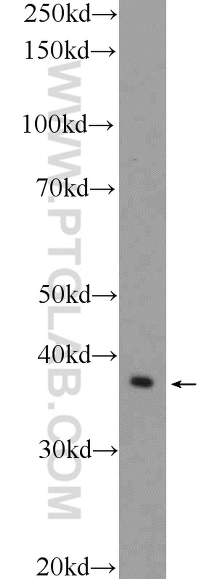 GNAO1 Antibody in Western Blot (WB)