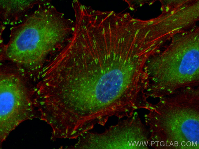 FAK Antibody in Immunocytochemistry (ICC/IF)