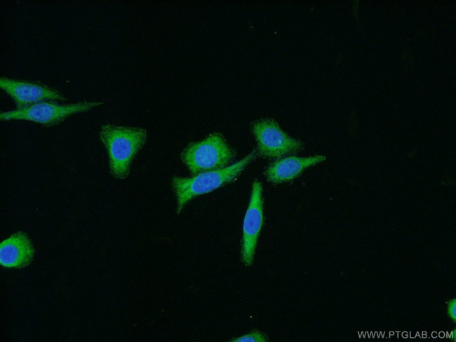 FAK Antibody in Immunocytochemistry (ICC/IF)