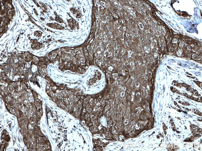 FAK Antibody in Immunohistochemistry (Paraffin) (IHC (P))