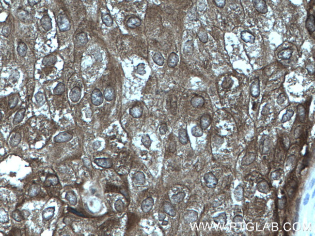 FAK Antibody in Immunohistochemistry (Paraffin) (IHC (P))