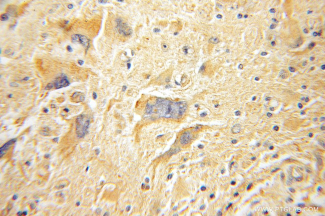 FAK Antibody in Immunohistochemistry (Paraffin) (IHC (P))