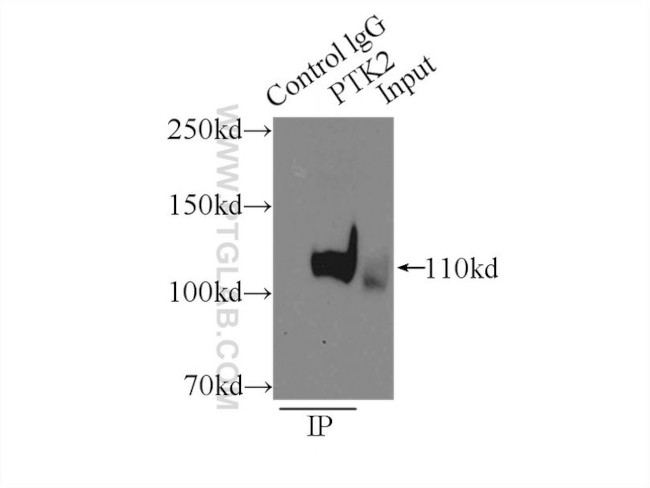 FAK Antibody in Immunoprecipitation (IP)