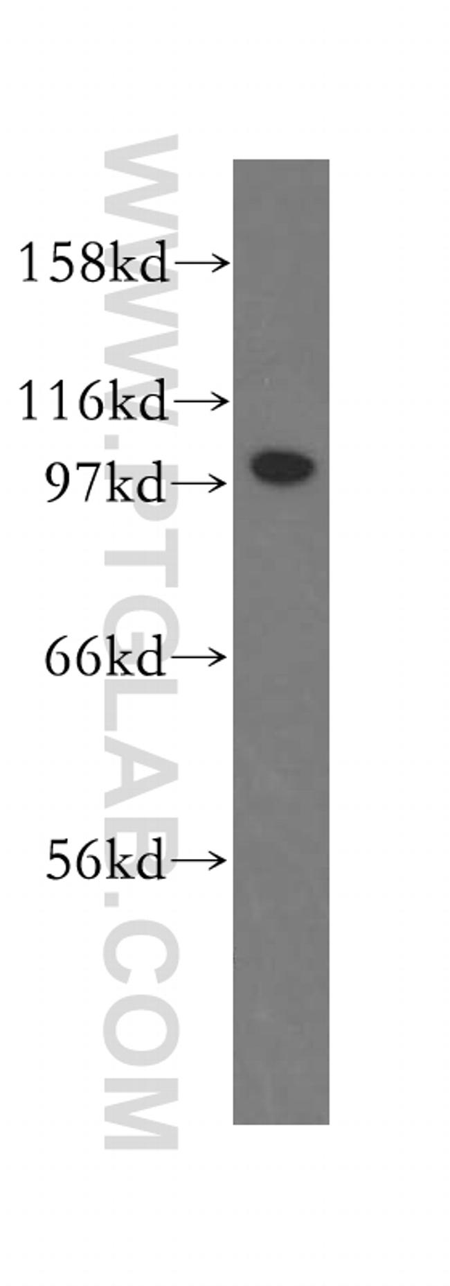 FAK Antibody in Western Blot (WB)