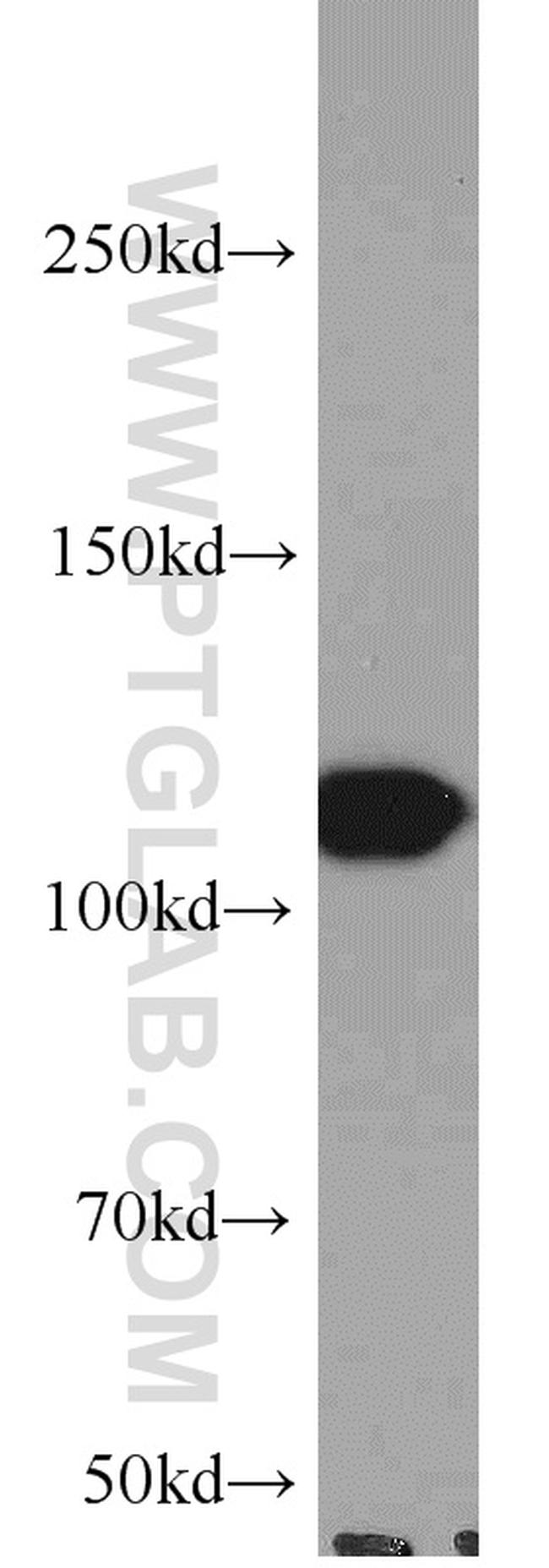 FAK Antibody in Western Blot (WB)