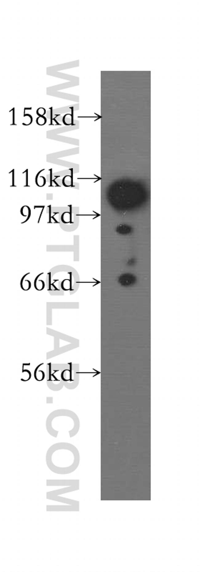 FAK Antibody in Western Blot (WB)