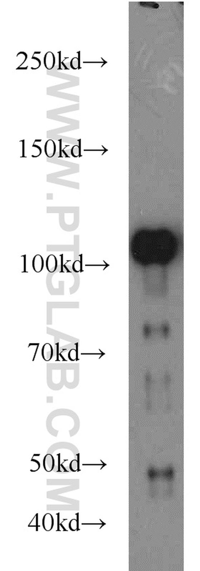 FAK Antibody in Western Blot (WB)