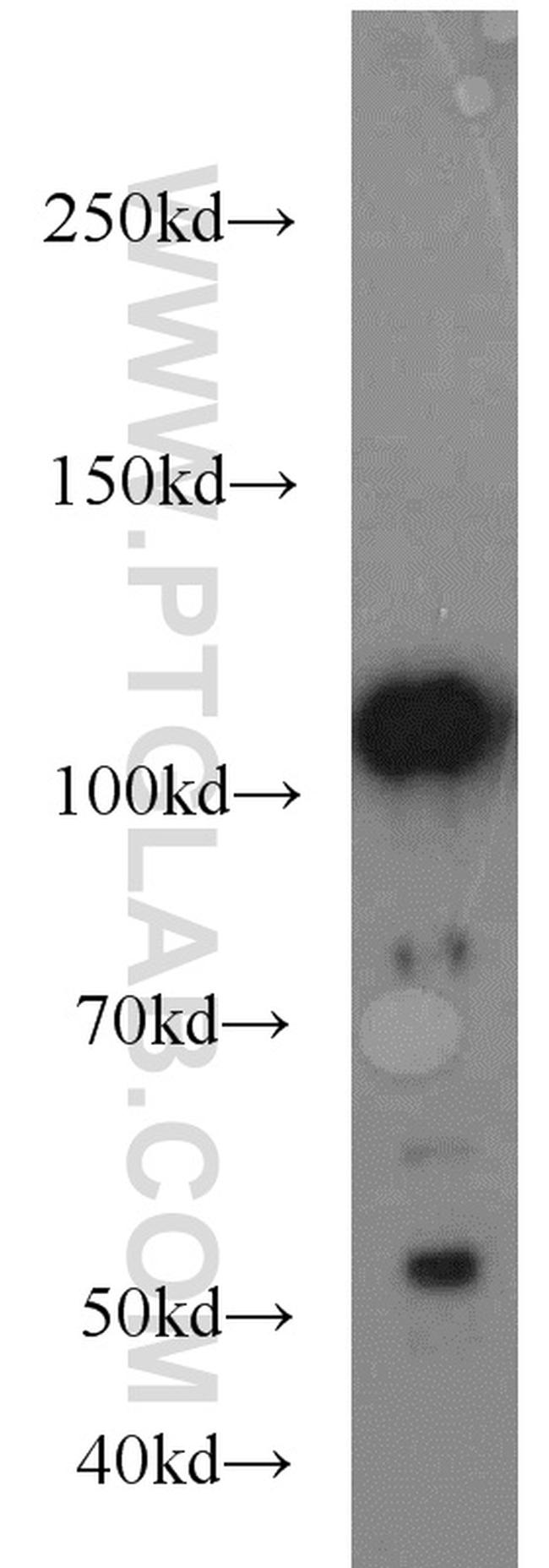 FAK Antibody in Western Blot (WB)