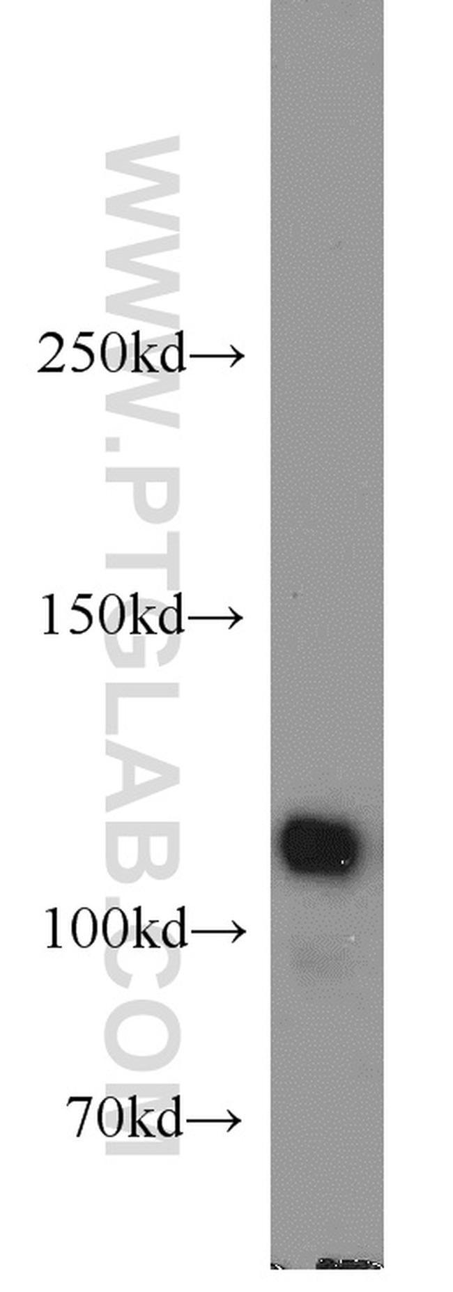 FAK Antibody in Western Blot (WB)