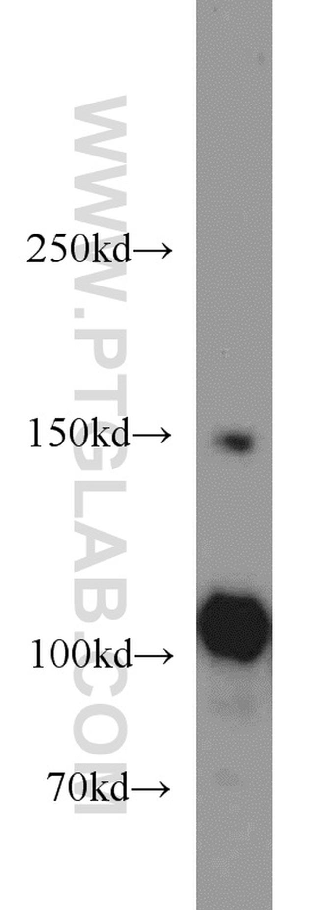 FAK Antibody in Western Blot (WB)