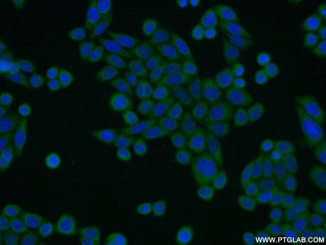 CIAPIN1 Antibody in Immunocytochemistry (ICC/IF)