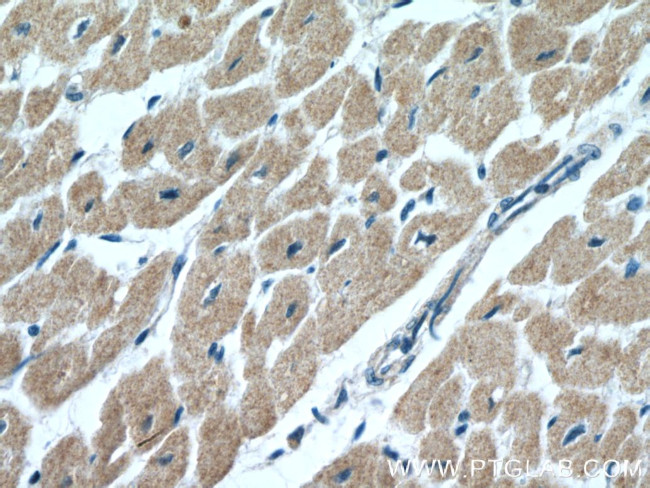 CIAPIN1 Antibody in Immunohistochemistry (Paraffin) (IHC (P))