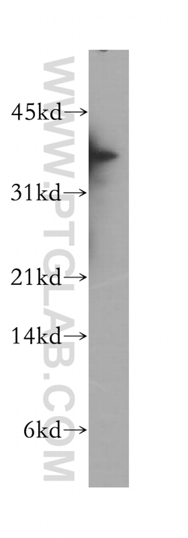 CIAPIN1 Antibody in Western Blot (WB)