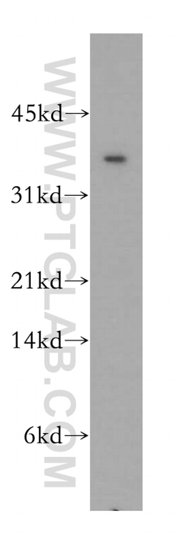 CIAPIN1 Antibody in Western Blot (WB)