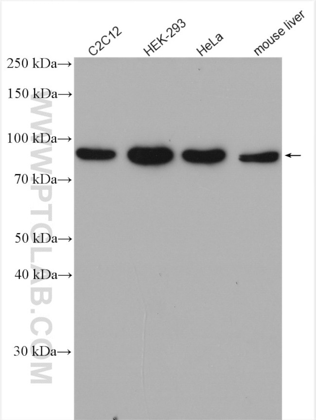 APPL1 Antibody in Western Blot (WB)