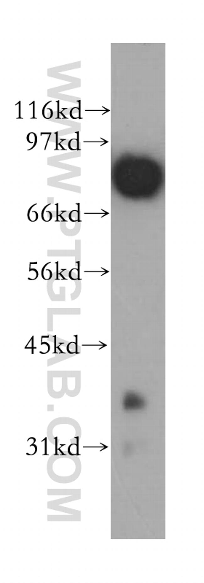 APPL1 Antibody in Western Blot (WB)