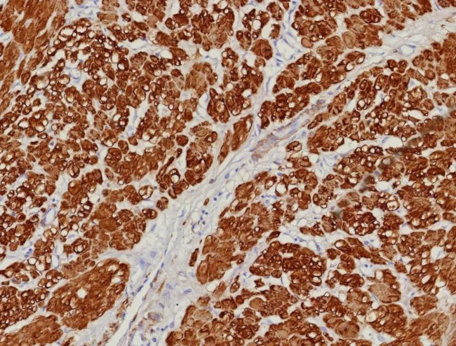 Calponin-1 (Smooth Muscle Marker) Antibody in Immunohistochemistry (Paraffin) (IHC (P))