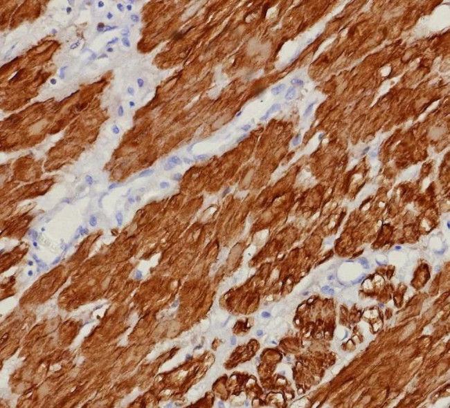 Calponin-1 (Smooth Muscle Marker) Antibody in Immunohistochemistry (Paraffin) (IHC (P))