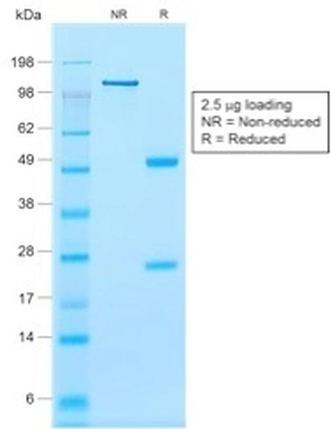 Calponin-1 Antibody in SDS-PAGE (SDS-PAGE)