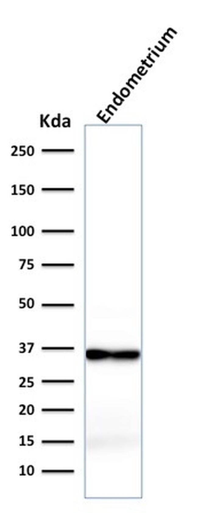 Calponin-1 Antibody in Western Blot (WB)