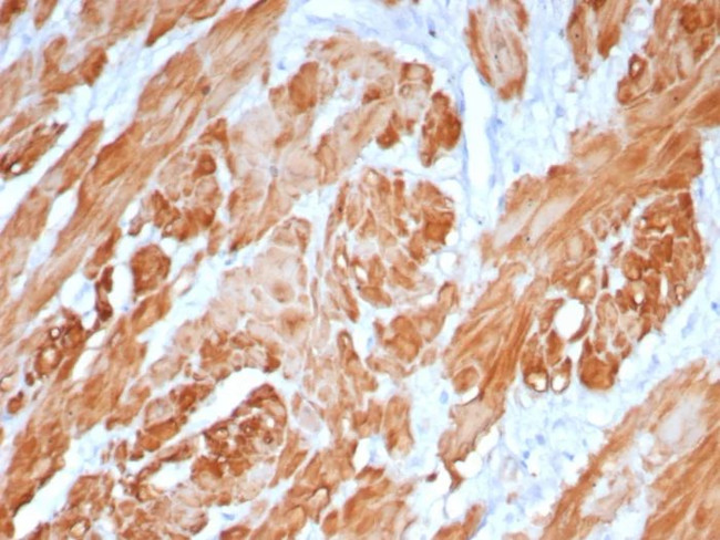 Calponin-1 (Smooth Muscle Marker) Antibody in Immunohistochemistry (Paraffin) (IHC (P))