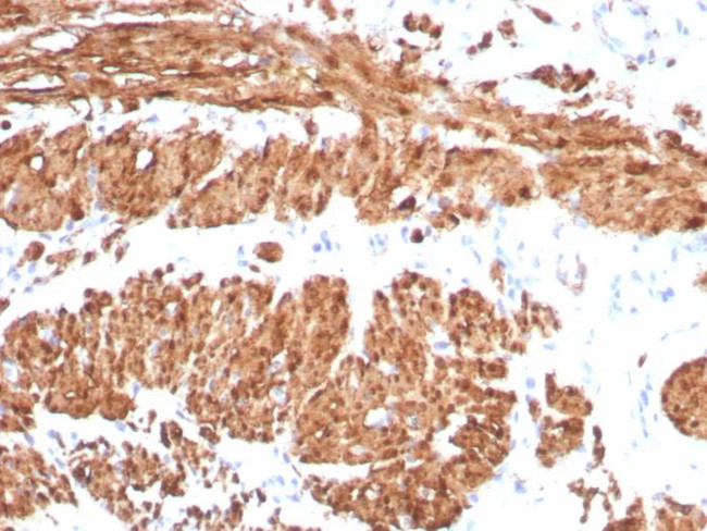 Calponin-1 (Smooth Muscle Marker) Antibody in Immunohistochemistry (Paraffin) (IHC (P))