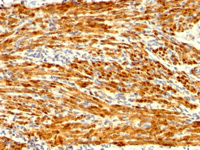 Calponin-1 Antibody in Immunohistochemistry (Paraffin) (IHC (P))