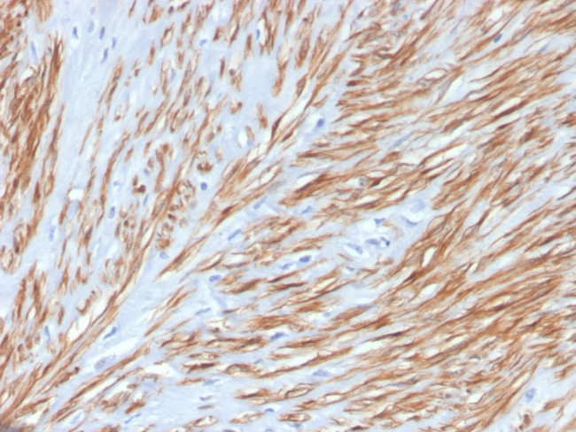 Calponin-1 Antibody in Immunohistochemistry (Paraffin) (IHC (P))