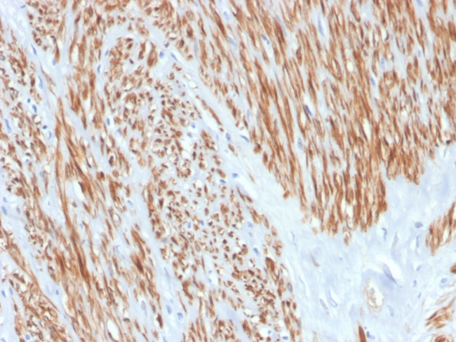 Calponin-1 Antibody in Immunohistochemistry (Paraffin) (IHC (P))