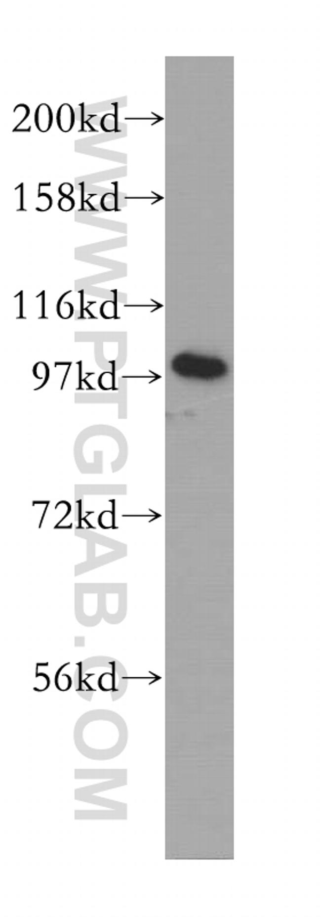 golgin 97 Antibody in Western Blot (WB)