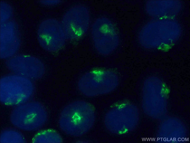 golgin 97 Antibody in Immunocytochemistry (ICC/IF)